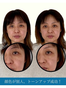 ハリラボ(hari Lab.)/【お客様の声】