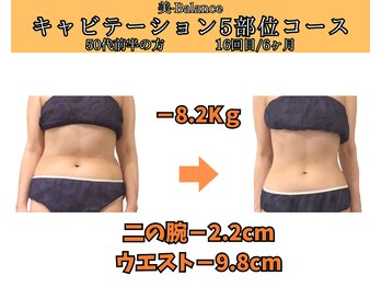 ビーバランス 本町店(美-Balance)/50代前半　月5部位コース