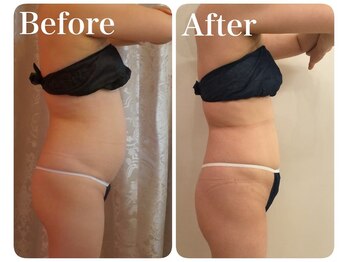 クイーン 熱海店(Queen)/たった60分で楽してダイエット!