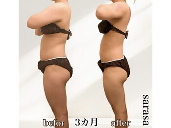 ナチュラル ビューティー スタイル さらさ(Natural Beauty Style)/さらさ痩身プログラム2カ月後