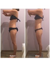 ナレル(narrel)/(新潟市/骨盤/痩身/ダイエット)