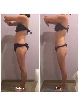 ナレル(narrel)/(新潟市/骨盤/痩身/ダイエット)