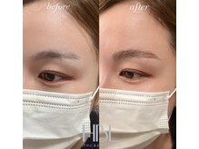 シエル(ciel)/before→after