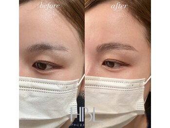 シエル(ciel)/before→after