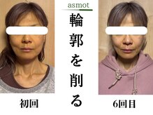 asmot鍼灸 整体院 代々木上原(asmot鍼灸 整体院)の雰囲気（美容鍼◎初回→3回目/代々木上原駅/美容鍼/整体/肩こり/腰痛）