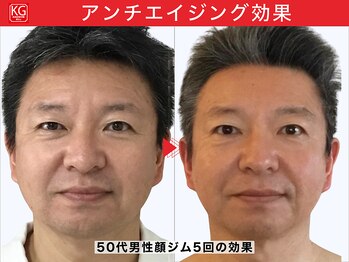 顔ジム 麻布十番店/50代男性顔ジム継続の効果