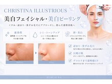 ビボーラ 大阪福島店 梅田(BEBEAURA)の雰囲気（美白ピーリングで明るい肌へ☆毛穴にお悩みの方にも◎梅田/福島）