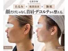 グロウ バイ フェイシャルデザイン アンド アイ(GROW)