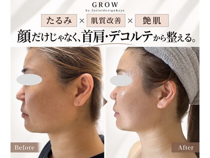 グロウ バイ フェイシャルデザイン アンド アイ(GROW)の写真