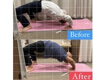 ナオル整体 宮崎院(NAORU整体)/40代男性施術事例【ブリッジ】