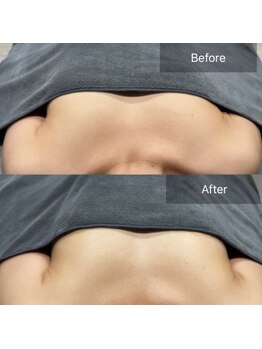 サロン リヒカ(Salon Rihica)/デコルテからふんわり美胸