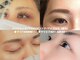 アイズラボ(Eyes Lab)の写真