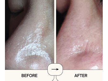 ビエストラ(Biestora)/ハイドロスプラッシュ