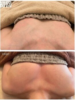 美人バスト 沼津店/【バストアップ★育乳】症例！！