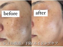 ホワイトアクア 高松店の雰囲気(ニキビケアだけでなくシミ・しわ・たるみ改善もお任せください)