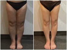 美容整体 ウェリナ 蟹江院/小顔矯正/骨盤矯正/美脚サロン 