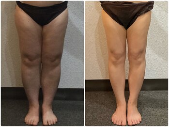 美容整体 ウェリナ 蟹江院/小顔矯正/骨盤矯正/美脚サロン 