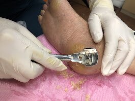 フットナース ケー(K)｜ホットペッパービューティー