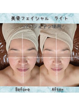 ラエッセス(A Laessess)/むくみ改善