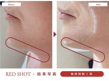 キワミ サーティスリー(kiwami33)/