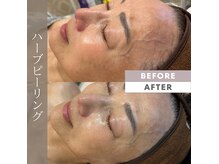 スウィート 矢場町店(Sweet)の雰囲気（シワたるみ/シミ/毛穴でお悩みの方エイジングケアはお任せ下さい）