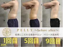 ペリー(PELLY)/男性20代　before after