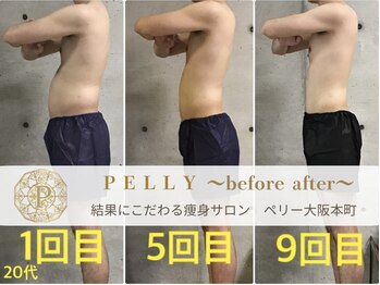 ペリー(PELLY)/男性20代　before after