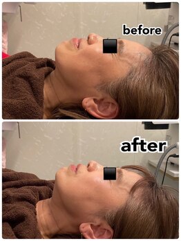 ミューズ よもぎ蒸し(MUSE)/◆インモード◆