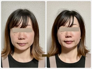 哲心 姫路/鏡を見るのが楽しみになりました