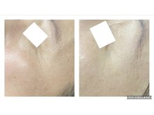 オアジスパ(Oasi Spa)/