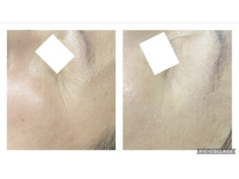 オアジスパ(Oasi Spa)/