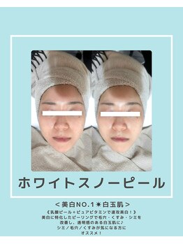 ソワナ(soina)/【神楽坂駅/フェイシャル/毛穴】