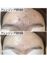 リュミエール デスポワール(Lumiere d'espoir)/ホームケア