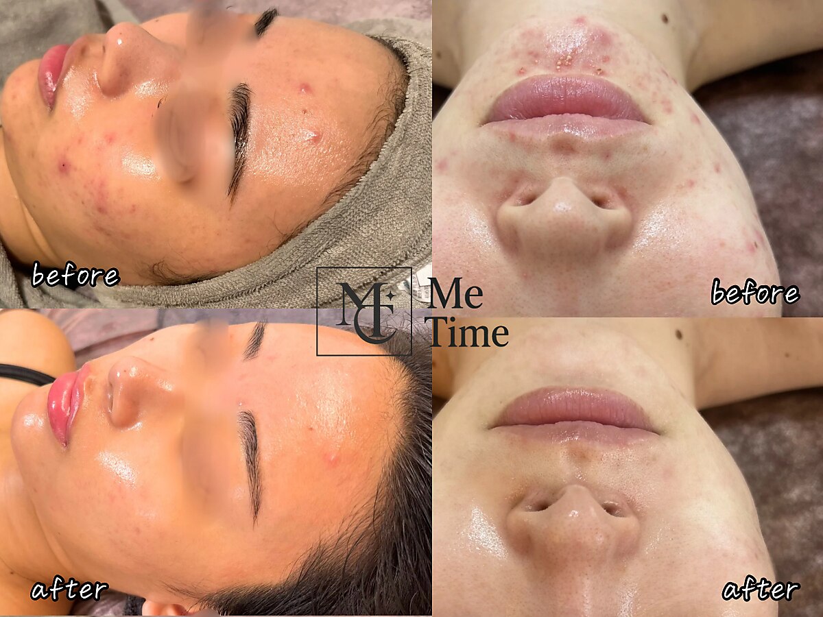 Y9440◇美品◇最高級毛皮*CLUBBY TIMEクラビータイム*MINKミンクヤーン*襟付き*リアルファー ジャケット*ハーフコート*ブラウン系*40/M相当 長時間保湿*¹してウルフに会いに行く！PHOEBE BEAUTY UP×WOLF HOWL