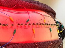 上葉鍼灸接骨院