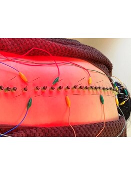 接骨院・整骨院で施術を受けたい