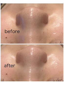 フェリーチェ(Felice)/黒ずみスッキリ