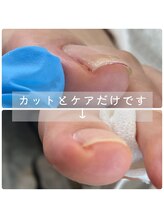 シュガーズネイル(sugar's nail)/足爪カット