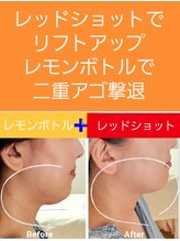 アン 銀座(ann)/ここまで変わる