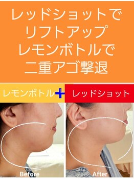 アン 銀座(ann)/ここまで変わる