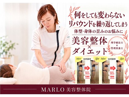 マルロ(MARLO)の写真