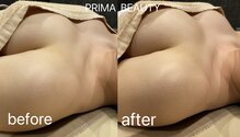 プリマビューティー 蒲生四丁目(PRIMA BEAUTY)
