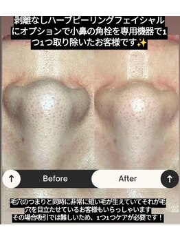 ビエストラ(Biestora)/剥離なしハーブ+オプション