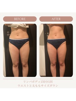 リンパ専門店 ファリンソ/リンパマッサージのBefore&After