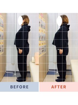 ナオル整体 三鷹院(NAORU整体)/40代女性施術事例【反り腰】