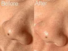 ジェジル バイ ジュリ(JAEJIL by Juri)/小鼻の産毛もWAXで一掃！