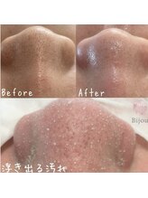 ビジュープラス ひたち野うしく店(Bijou+)/