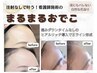 【横顔美人ふっくらおでこ！】ヒアルリッチで丸みのあるおでこへ