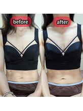 スノードロップ(snowdrop)/バストアップ　痩せ体型の方