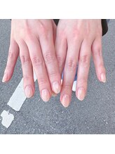 ティリット(TILLIT)/